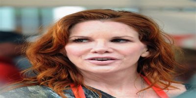 Melissa Gilbert’s ‘Great’ Face Didn’t Feel like Hers in Her 40s before Earning ‘Freedom’