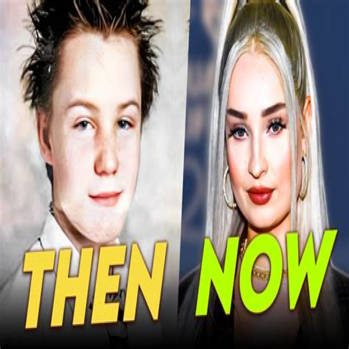 Unveiling The Journey: Kim Petras Before Transition